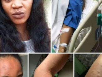 Pray for me, my Doctors said I May diie Soon – Nollywood Actress Uche Ogbodo cries Out (Photos) It’s so sád, don’t pass without praying for her .. Pray for her for quick recovery ?