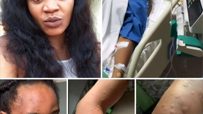 Pray for me, my Doctors said I May diie Soon – Nollywood Actress Uche Ogbodo cries Out (Photos) It’s so sád, don’t pass without praying for her .. Pray for her for quick recovery ?